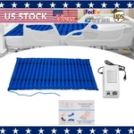 Alternating Pressure Pad Air Mattress For Hospital Bed Topper & Pump. Fixed Price $83.66.